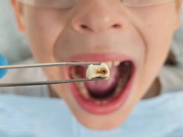 Best Emergency Orthodontic Repairs in Deforest, WI